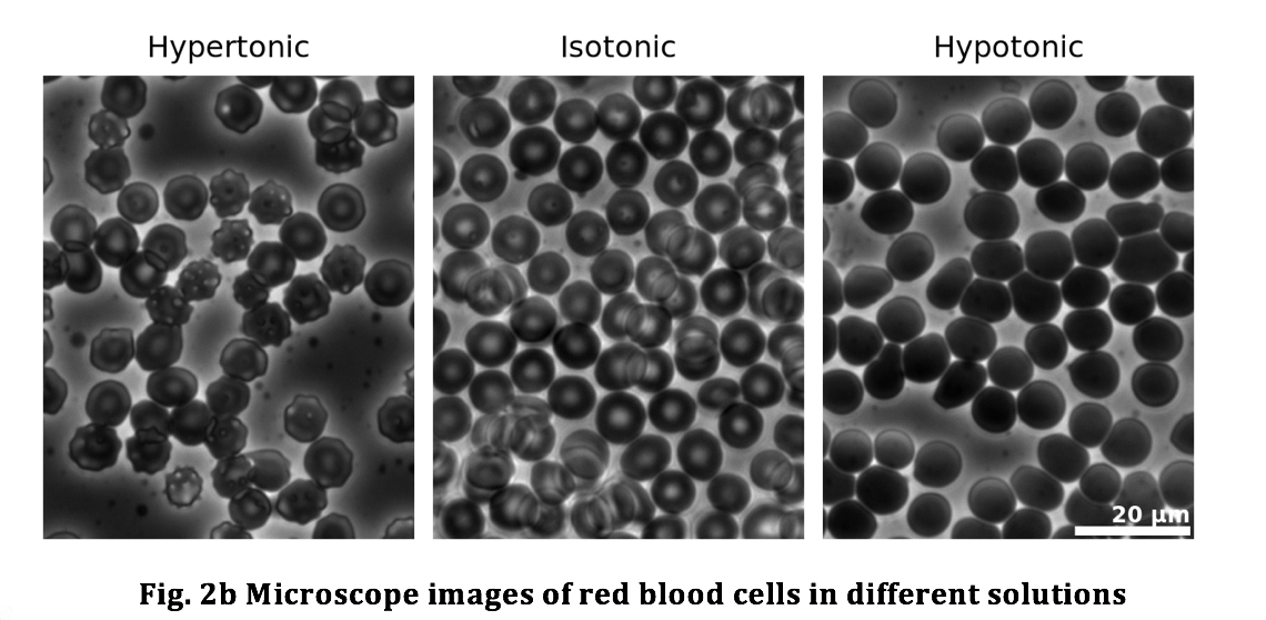 A Red Blood Cell Placed In A Hypertonic Medium Will